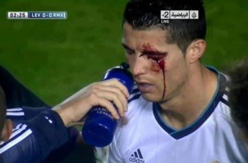 kaiyun-莱万特旧将：我过去曾无意肘击C罗，媒体却几乎要把我关进监狱